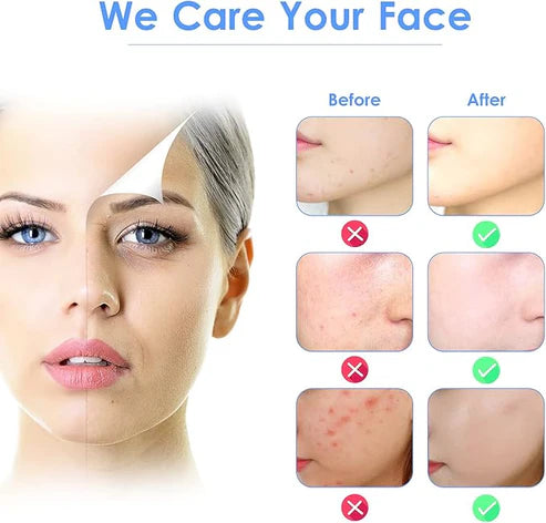 3-in-1 Ultrasonic Facial Skin Scrubber – Deep Clean, Lift & Nourish Your Skin at Home